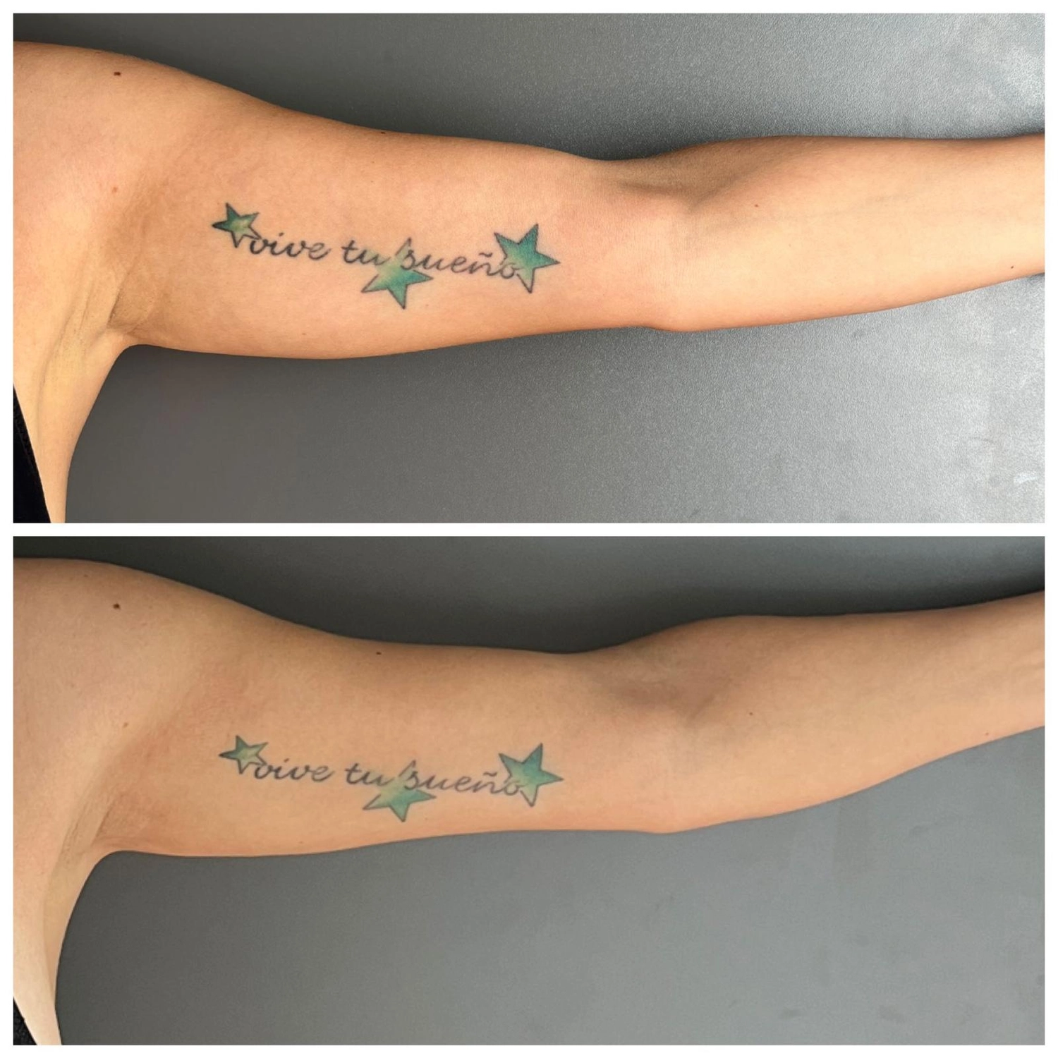 Spirit of Beauty – Beate Heinig – Wellness- und Schönheitssalon – Ergebnisse von Body Farming