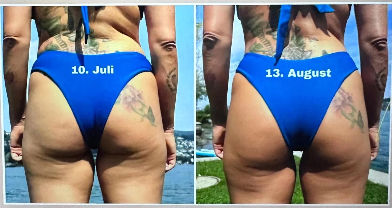 Spirit of Beauty – Beate Heinig – Wellness- und Schönheitssalon – Ergebnisse von Body Farming